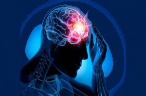 epilepsia