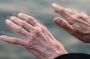 parkinson-2309103