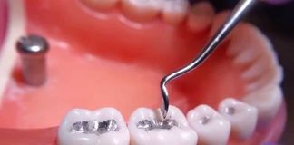 Firman acuerdo para reducir el uso de mercurio en odontología