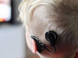 San Isidro: jornada de implante coclear para profesionales de la salud