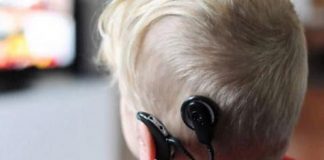 San Isidro: jornada de implante coclear para profesionales de la salud