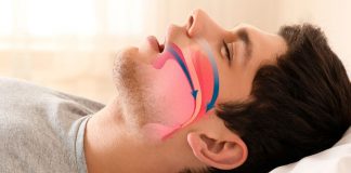 Primera encuesta sobre Apnea Obstructiva del sueño en Argentina