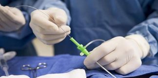 En Argentina se realiza un procedimiento por cateterismo cada 2 minutos