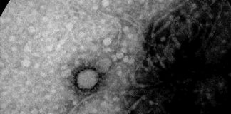 El Malbrán captó la primera foto del SARS-CoV-2 que circula en Argentina