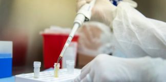 Avances para producir los primeros test de coronavirus SARS-CoV-2 en Argentina