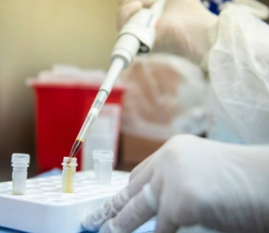 Avances para producir los primeros test de coronavirus SARS-CoV-2 en Argentina