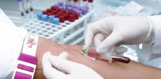 Nuevo test de sangre detecta el cáncer en 10 órganos diferentes