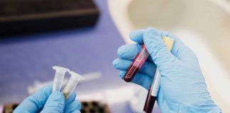 El primer análisis de sangre que detecta con precisión más de 50 tipos de cáncer