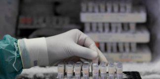 Estudio de vigilancia sanitaria de Covid-19