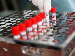 Covid-19: buscan desarrollar un test de PCR más simple y económico