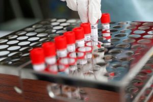 crear test pcr