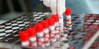 Covid-19: buscan desarrollar un test de PCR más simple y económico