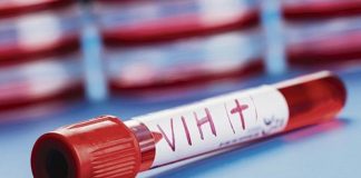 Medicación para pacientes VIH durante la pandemia