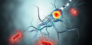 Delirio, ictus o daño nervioso: complicaciones neurológicas del COVID-19