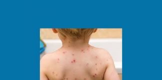 El gobierno de la provincia anuncia el cese del brote de sarampión