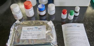 El test serológico argentino para COVID-19 llegó a los 100.000 ensayos