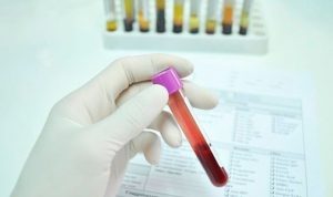 un-analisis-de-sangre-detecta-el-cancer-4-anos-antes-de-su-aparicion-8852