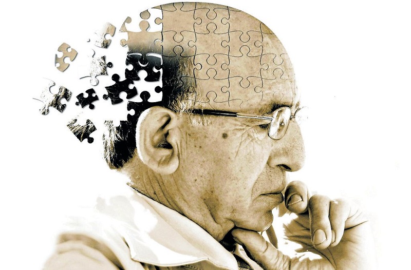 ALZHEIMER - taller