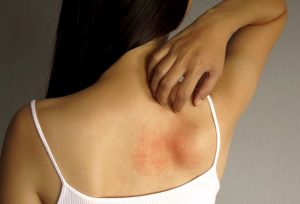 DERMATITIS 2020 a
