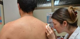 «Vamos al Punto»: ¿Te chequeaste los lunares este año?