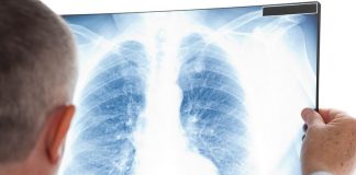 Controles clínicos para pacientes post Covid-19