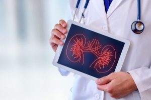 Covid-19: ¿Por qué es importante vacunar a pacientes con enfermedad renal crónica?