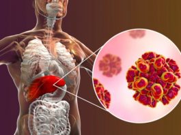 Nueva guía y estrategias para facilitar el acceso al diagnóstico de hepatitis B y C