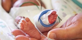 En Argentina cada año nacen 8 mil bebés prematuros