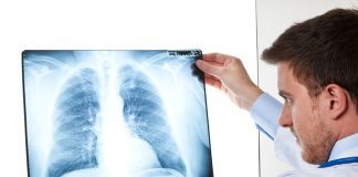 Cáncer de pulmón: lanzan campaña para detectarlo a tiempo