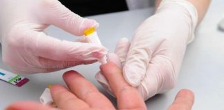 Hepatitis aguda infantil: ya hay más de 420 casos