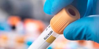 Hepatitis infantil: estudian ocho casos sospechosos de origen desconocido