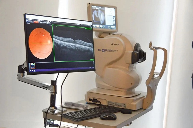 tomografo optico