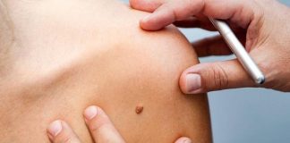 Tigre promueve la campaña de control “Salva Tu Piel”