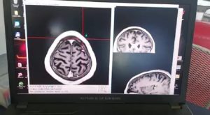 Parkinson - Foto 3