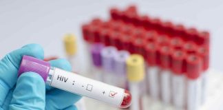 Mas de 140 mil personas viven con VIH y un 13% lo desconoce