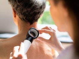 «MelaNOmás», una campaña para generar conciencia sobre melanoma y cáncer de piel