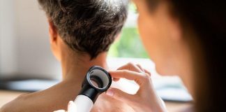 «MelaNOmás», una campaña para generar conciencia sobre melanoma y cáncer de piel