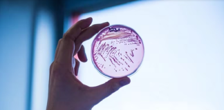 En Argentina se registró un aumento del Síndrome Urémico Hemolítico