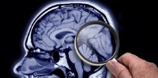 ELA: el abordaje multidisciplinario permite alcanzar mejores resultados