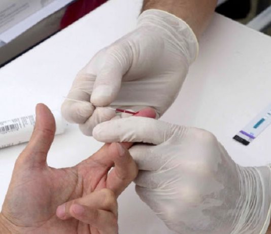 Día Mundial de Respuesta al VIH: habrá testeos, charlas y capacitaciones en Provincia