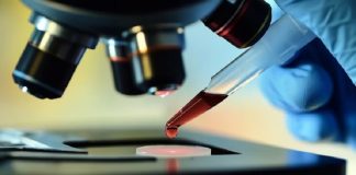 Según una organización mundial de lucha contra el sida, el 44% de los nuevos casos son mujeres jóvenes y adolescentes