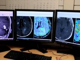 Cáncer de próstata: el Instituto Alexander Fleming suma inteligencia artificial para agilizar diagnósticos