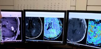 Cáncer de próstata: el Instituto Alexander Fleming suma inteligencia artificial para agilizar diagnósticos