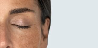 Manchas cutáneas, una mirada integral sobre las señales que deja la piel