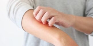 Dermatitis atópica: campaña gratuita de detección de esta enfermedad de la piel en todo el país