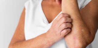 Comenzó la campaña de detección gratuita de enfermedad psoriásica