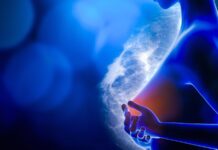 Cáncer de mama temprano: nueva terapia para reducir recaídas