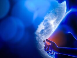 Cáncer de mama temprano: nueva terapia para reducir recaídas