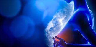 Cáncer de mama temprano: nueva terapia para reducir recaídas
