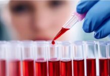 Leucemia mieloide crónica: el avance de la ciencia mejora la calidad de vida de los pacientes